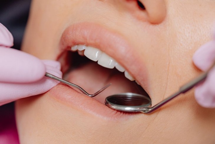Tratamento de gengivite: guia prático e técnico para pacientes
