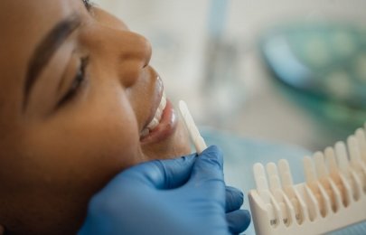 Lente de contato para dentes em São Miguel do Oeste - guia técnico e prático
