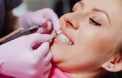 Facetas de porcelana vs lentes ultrafinas: o que funciona em São Miguel do Oeste