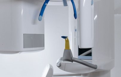Radiologia odontológica em São Miguel do Oeste: benefícios e segurança
