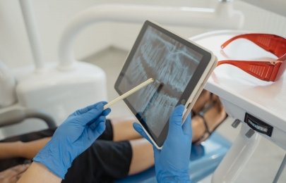 Teleodontologia para triagem pediátrica e acompanhamento de higiene bucal