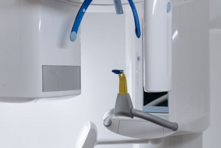 Radiologia odontológica em São Miguel do Oeste: benefícios e segurança