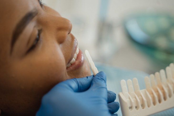 Lente de contato para dentes em São Miguel do Oeste - guia técnico e prático