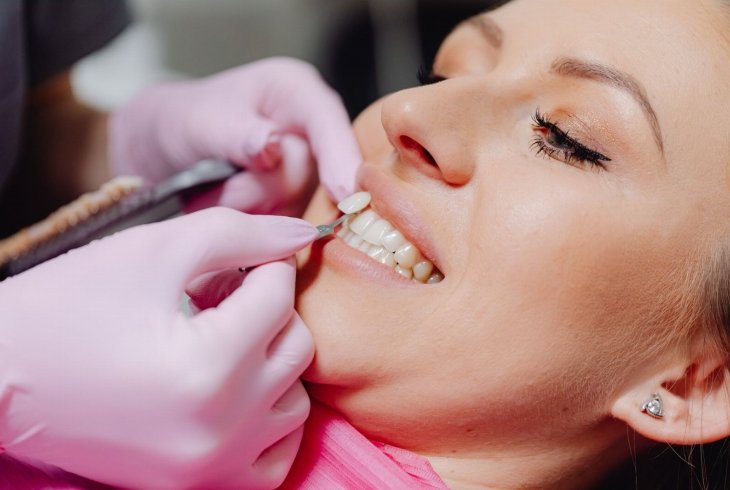 Facetas de porcelana vs lentes ultrafinas: o que funciona em São Miguel do Oeste