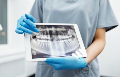 Guia passo a passo: Disfunção temporomandibular em São Miguel do Oeste