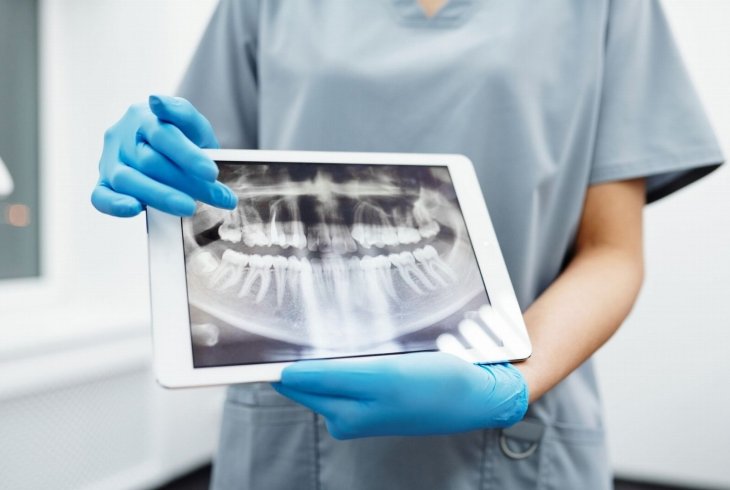 Radiologia odontológica em São Miguel do Oeste: guia passo a passo